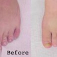 Foot Surgery to Make Shoes Fit? What a choice facing women who want to be fashionable: cut the shoes to fit the feet? Or Cut the feet to fit the shoes? Recent news reports suggest many fashionistas are choosing to cut their feet. Surgery to shorten toe bones to better fit current shoe styles is on the rise.
Couldn't women just wear bigger size shoes?
It's not enough to just get a shoe long enough. Women are influenced by the media and peer pressure. <div class="addthis_toolbox addthis_default_style addthis_" addthis:url='http://asktheshoelady.com/2009/05/foot-surgery-to-make-shoes-fit/' addthis:title='Foot Surgery to Make Shoes Fit?' ><a class="addthis_button_preferred_1"></a><a class="addthis_button_preferred_2"></a><a class="addthis_button_preferred_3"></a><a class="addthis_button_preferred_4"></a><a class="addthis_button_compact"></a></div>
